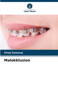 Malokklusion