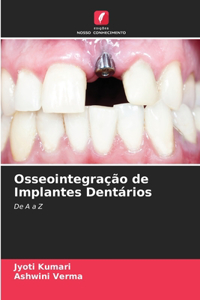 Osseointegração de Implantes Dentários