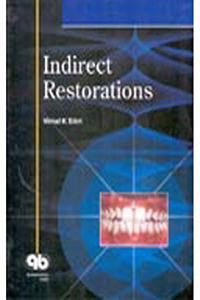 Indirect Restorations
