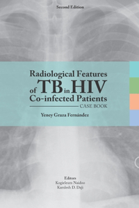 Radiological features of TB in HIV Co-infected Patients. Case book