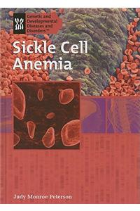 Sickle Cell Anemia