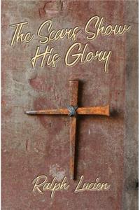 The Scars Show His Glory