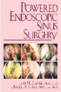 Powered Endoscopic Sinus Surgery