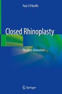 Closed Rhinoplasty