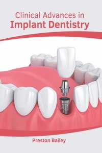 Clinical Advances in Implant Dentistry