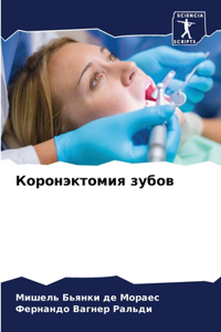 Коронэктомия зубов