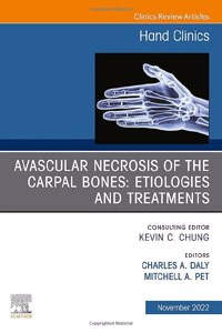 Avascular Necrosis of the Carpal Bones: Etiologies and Treatments, An Issue of Hand Clinics
