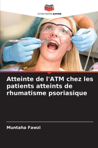 Atteinte de l'ATM chez les patients atteints de rhumatisme psoriasique