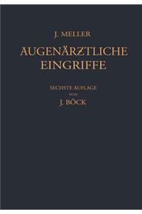 Augenärztliche Eingriffe