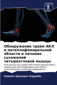 Обнаружение травм АКЛ и пателлофеморальн