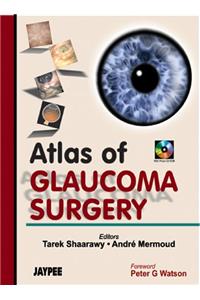 Atlas of Glaucoma Surgery