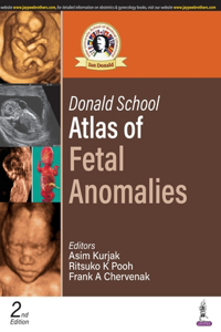 Donald School Atlas of Fetal Anomalies