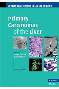 Primary Carcinomas of the Liver