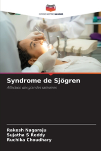 Syndrome de Sjögren