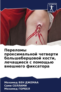 Переломы проксимальной четверти большеб&