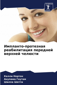 Импланто-протезная реабилитация передне&