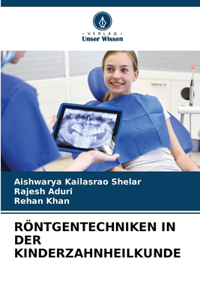 Röntgentechniken in Der Kinderzahnheilkunde