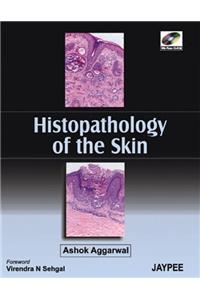 Histopathology of the Skin (with CD-ROM)