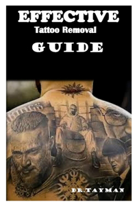 Effective Tattoo Removal Guide