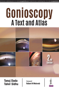 Gonioscopy: A Text and Atlas