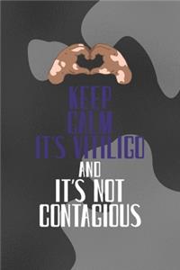 Keep Calm It's Vitiligo And It's Not contagious