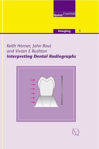 Interpreting Dental Radiographs