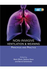 Non-Invasive Ventilation and Weaning: Principles and Practice