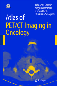 Atlas of Pet/CT Imaging in Oncology