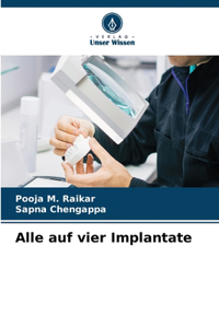 Alle auf vier Implantate