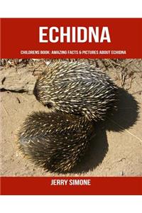 Childrens Book: Amazing Facts & Pictures about Echidna