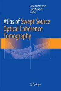 Atlas of Swept Source Optical Coherence Tomography