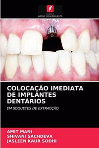 Colocação Imediata de Implantes Dentários