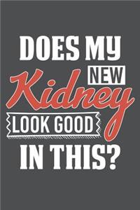 Does My New Kidney Look Good In This