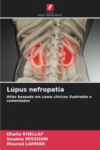 Lúpus nefropatia