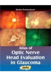 Atlas of Optic Nerve Head Evaluation in Glocauma