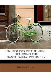 On Diseases of the Skin, Including the Exanthemata, Volume IV