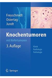 Knochentumoren Mit Kiefertumoren