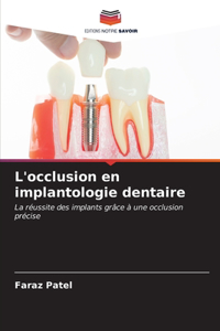 L'occlusion en implantologie dentaire