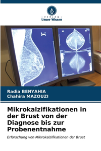 Mikrokalzifikationen in der Brust von der Diagnose bis zur Probenentnahme