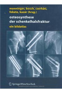 Osteosynthese der schenkelhalsfraktur