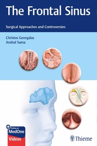 Frontal Sinus