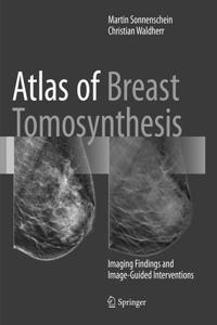 Atlas of Breast Tomosynthesis