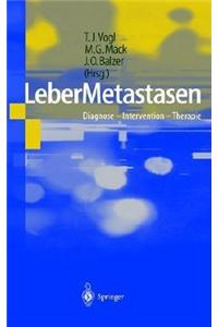 Lebermetastasen