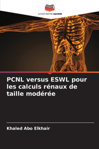 PCNL versus ESWL pour les calculs rénaux de taille modérée