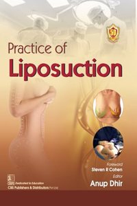 Practice of Liposuction (PB-2024)