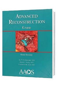 Advanced Reconstruction: Knee