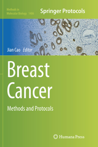 Breast Cancer