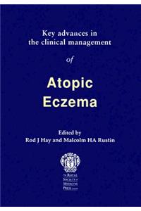 Key Advances in the Clinical Management of Atopic Eczema