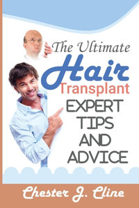 The Ultimate Hair Transplant Guide