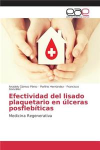 Efectividad del lisado plaquetario en úlceras posflebíticas
